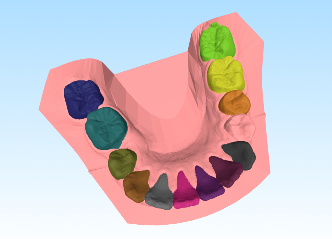 Tooth Segmentation Visualization