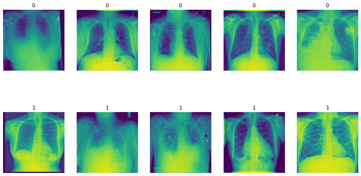 X-ray images