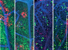 Tri-color x-ray fluorescence images of dicot leaves