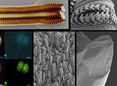 Images of the Cryptochiton stelleri and gumboot chiton ultrahard teeth