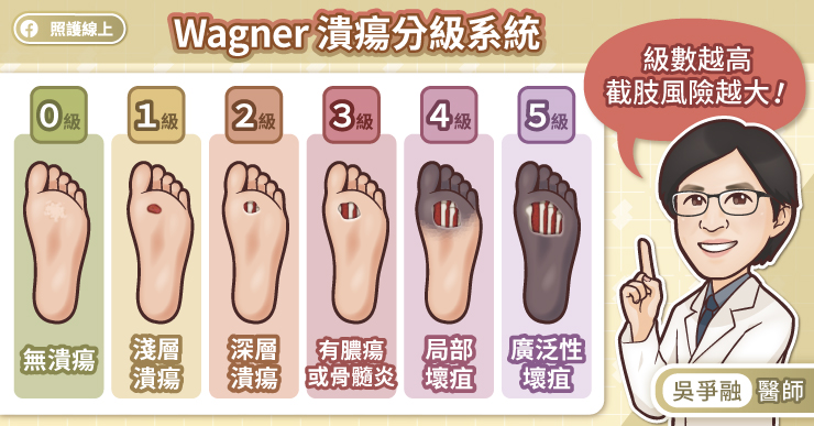 Wagner潰瘍分級系統