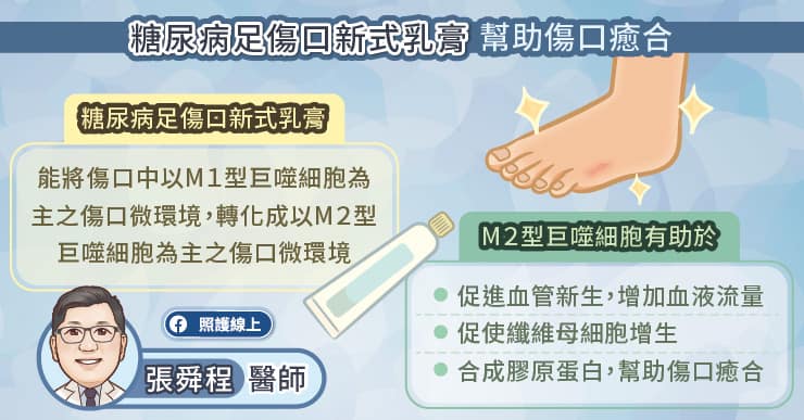 糖尿病足傷口新式乳膏幫助傷口癒合