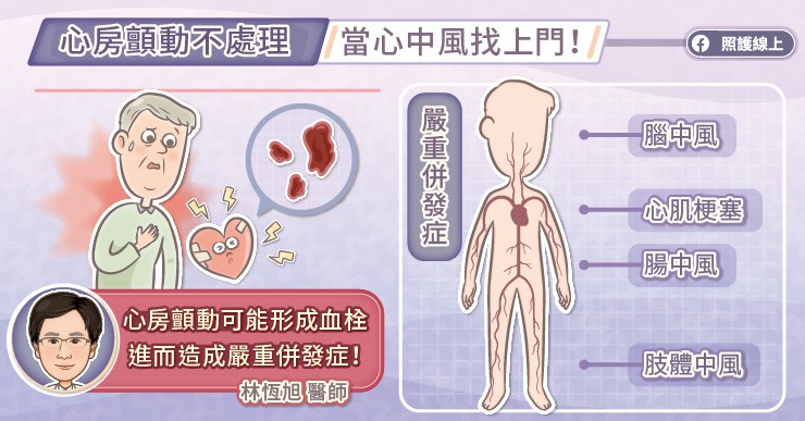 心房顫動不處理當心中風