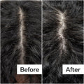 Before and after results of using Act+Acre Cold Processed Scalp Detox