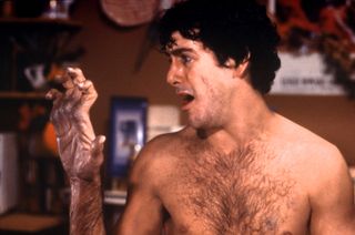 a man turning into a wolf on his hand in An American Werewolf in London