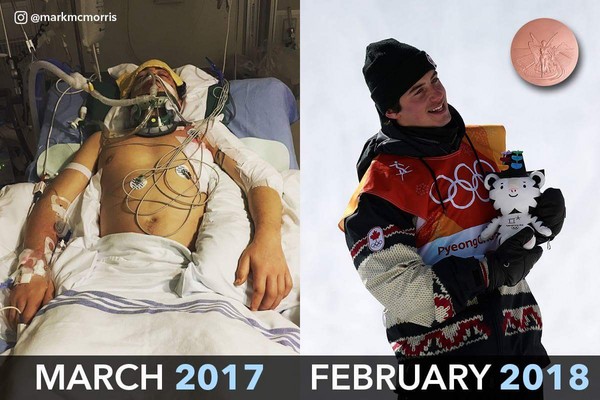 ▲▼ 11個月前從鬼門關前走一遭，麥克莫里斯（Mark McMorris）奪下自由式滑雪男子坡面障礙技巧賽（Slopestyle）銅牌。。（圖／翻攝自Twitter／Olympics‏）