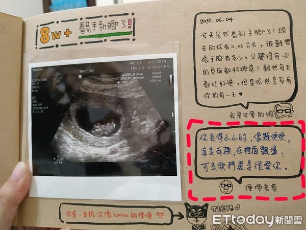 ▲超音波日記！孕妻一翻「像顆便便」秒吐血　隊友歪樓全記錄...惹網笑噴。（圖／原po授權提供）