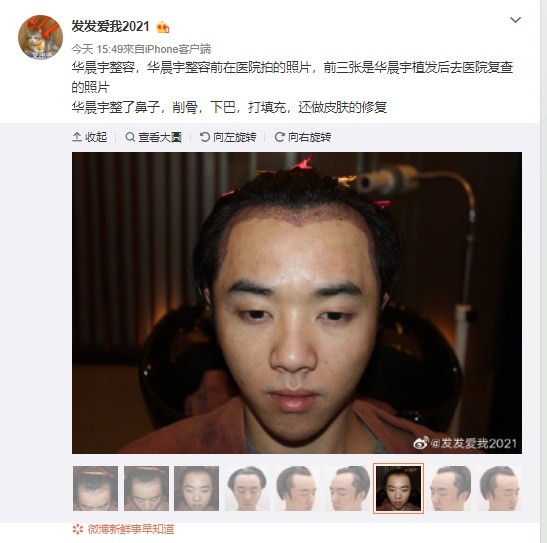 ▲華晨宇被爆渣男「張碧晨是小三」　疑正宮曝床上私密片、整形黑料。（圖／翻攝自微博／發發愛我2021）