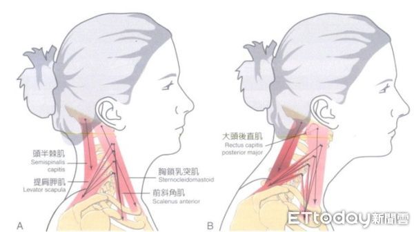 ▲貴婦包。（圖／台中榮總埔里分院提供）