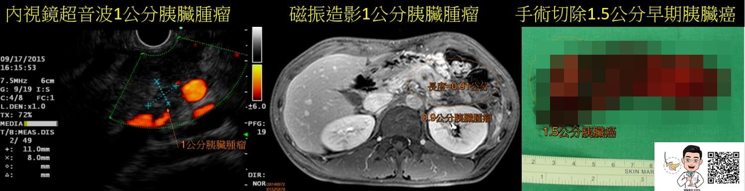 2男罹癌王！醫驚見「5大共通點」：下巴快掉下來　有1症狀已晚期。（圖／林相宏醫師授權提供）