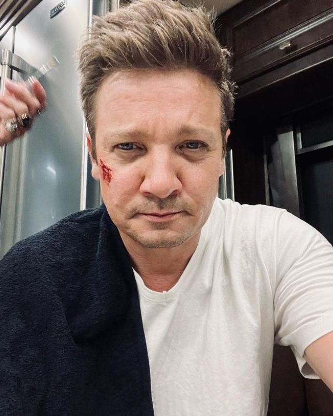 ▲「鷹眼」傑瑞米雷納因剷雪受到嚴重的傷。（圖／翻攝自Instagram／Jeremy Renner）