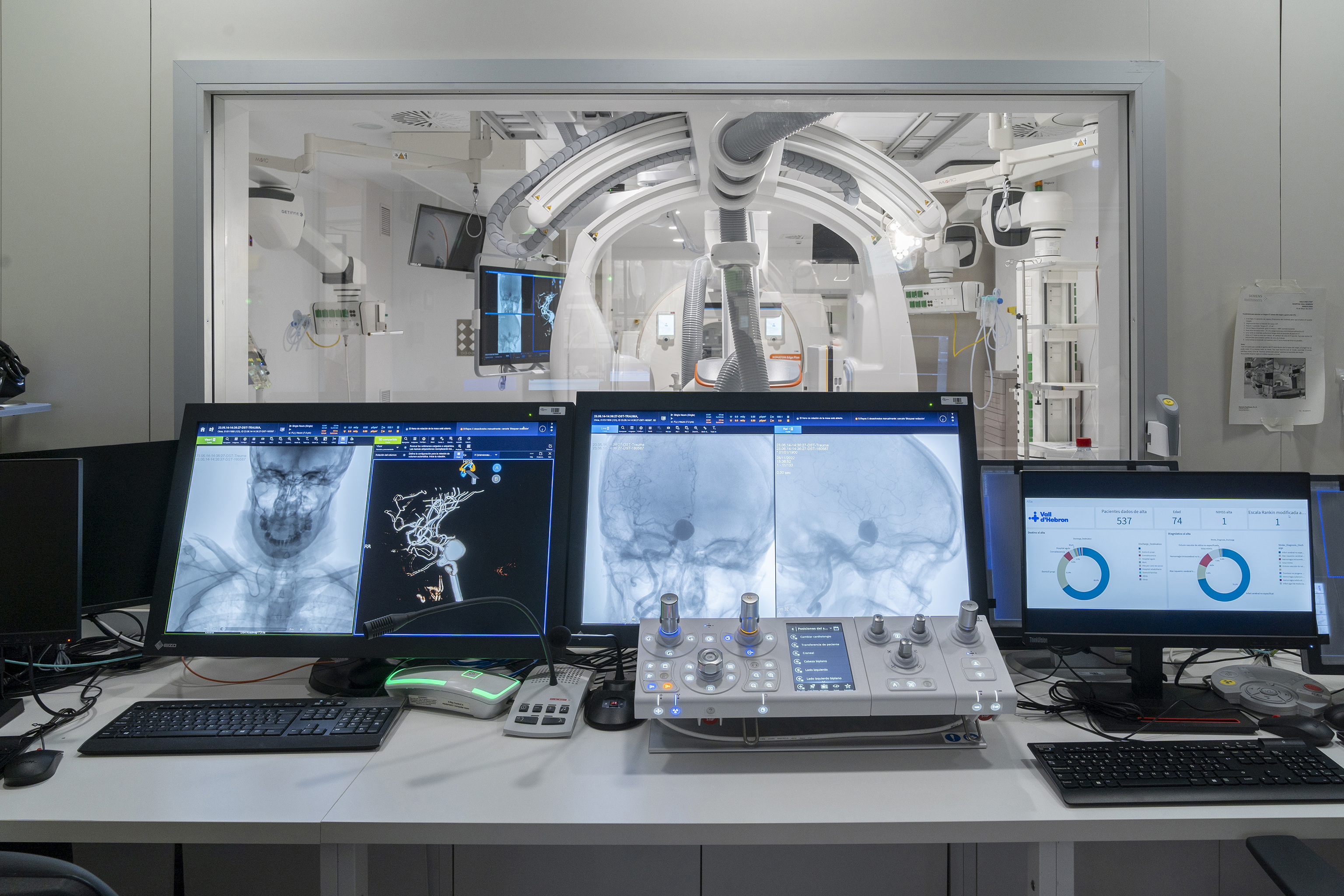 Una muestra de la equipaci�n tecnol�gica que permite una nueva forma de abordaje del ictus gracias al uso de nuevas tecnolog�as en el Vall D'Hebron.