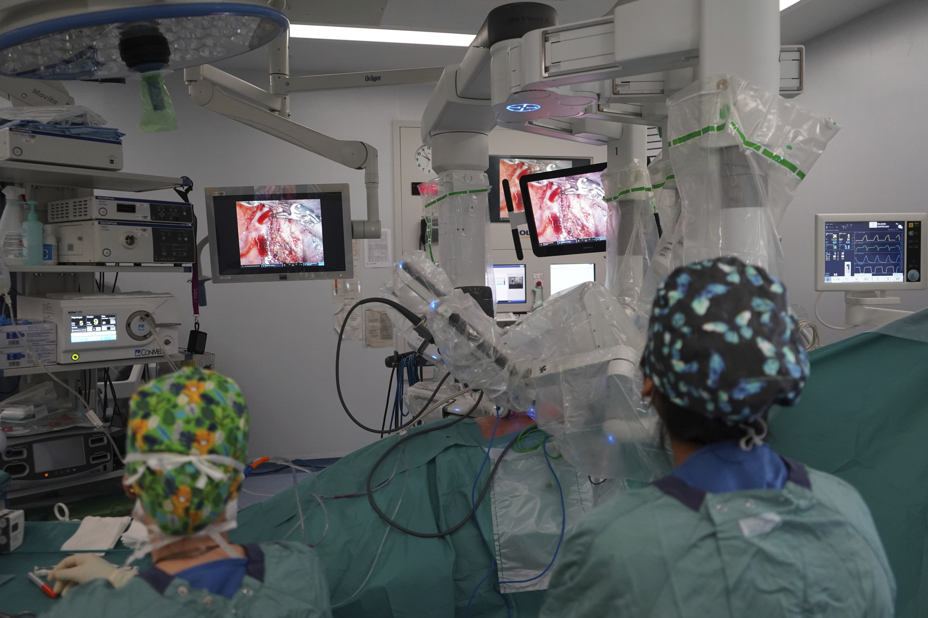 Operaci�n de c�ncer de pul�n en el Hospital Vall d'Hebron de Barcelona.