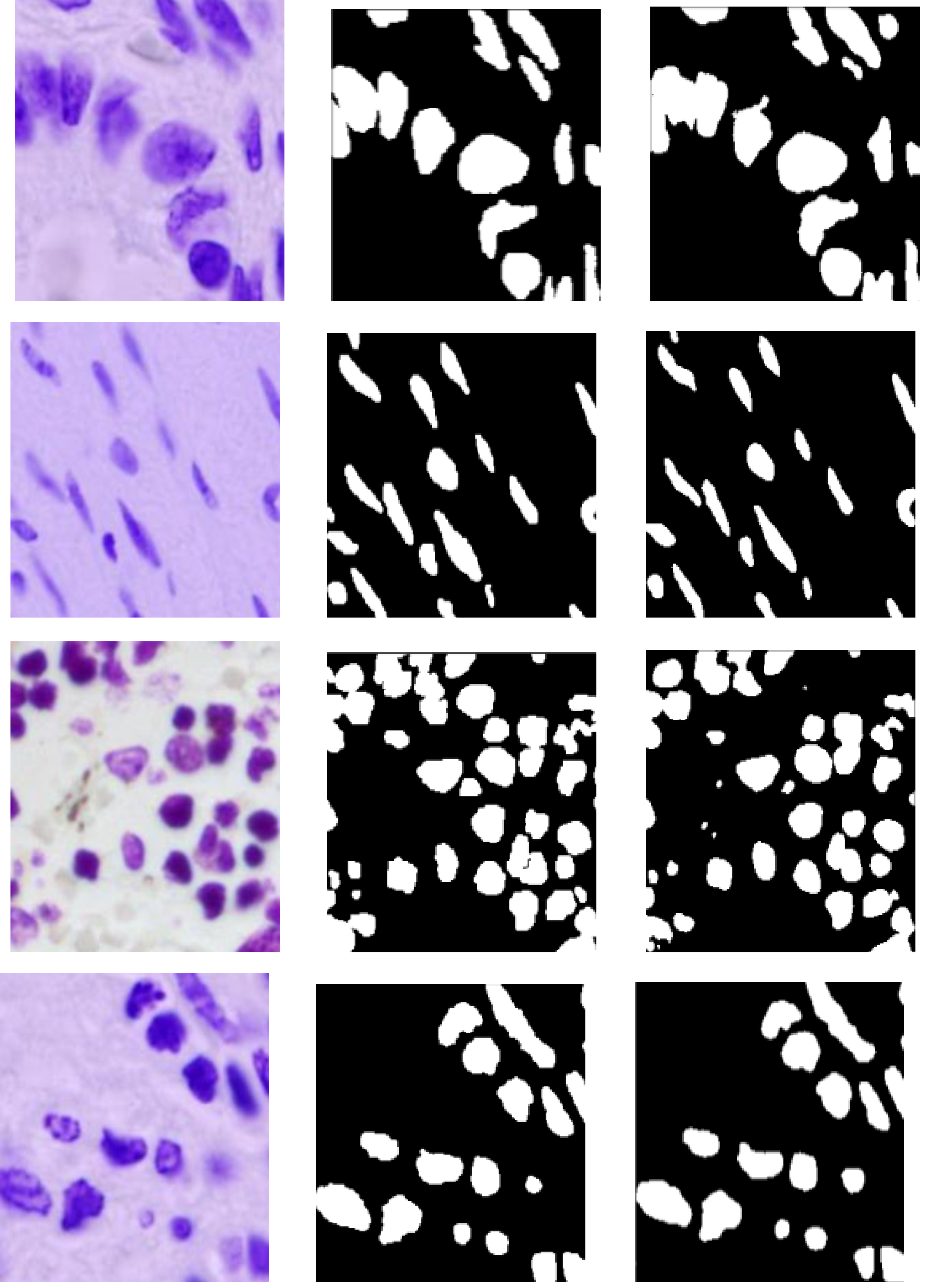 Cell Nuclei Segmentation results