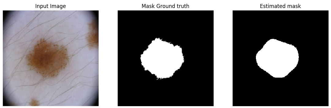 Skin Lesion Segmentation result 1