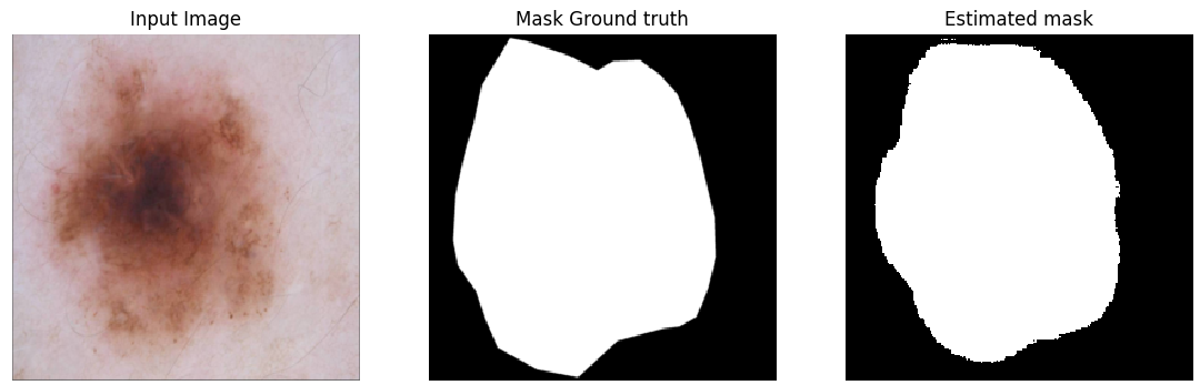 Skin Lesion Segmentation result 1