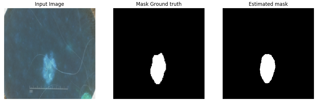 Skin Lesion Segmentation result 1