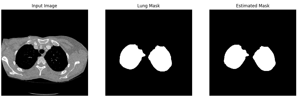 Lung Segmentation result 2