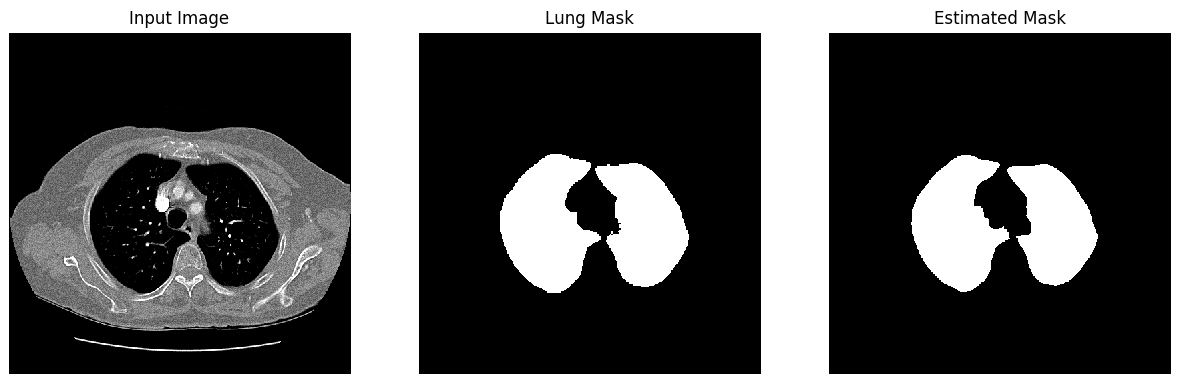 Lung Segmentation result 3