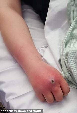 She was put on an IV drip and at one point doctors said she might lose her hand