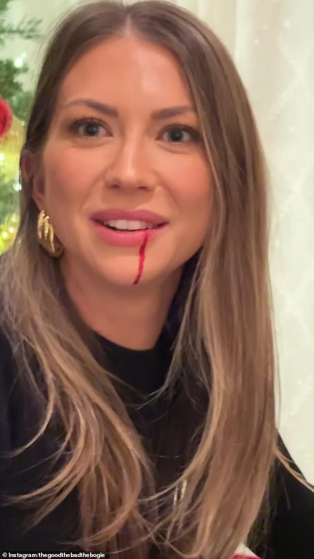 When Stassi's lip began to let out more blood, her toddler ran to the kitchen to get napkins to stop the bleeding