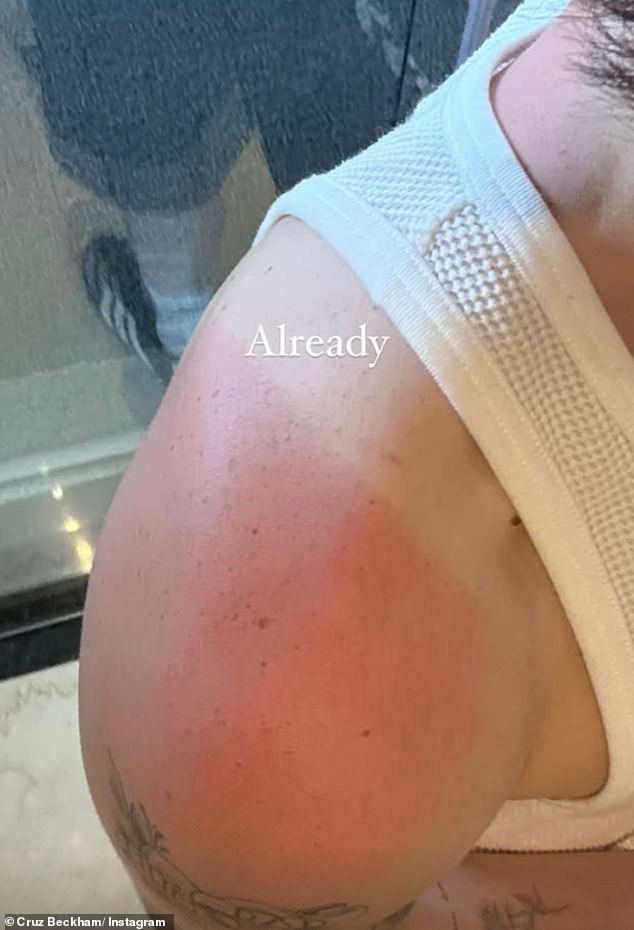 Taking to Instagram after their day out in Rio - where temperatures are currently as high as 25 degrees - Cruz revealed his sunburn with the accompanying comment: 'Already'