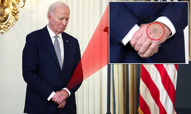 Mysterious mark appears on Biden's hand during White House appearance