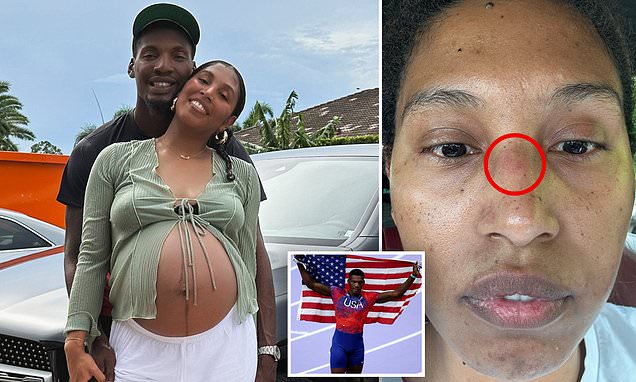 Fred Kerley's wife claims the Olympic sprinter is a 'serial cheat' who battered her to a