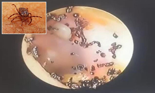 Horrified doctors find creatures breeding in little girl's ear after parenting mistake