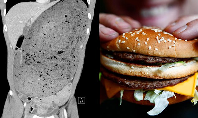 Man rushed to ER after losing key bodily function from eating a burger too fast