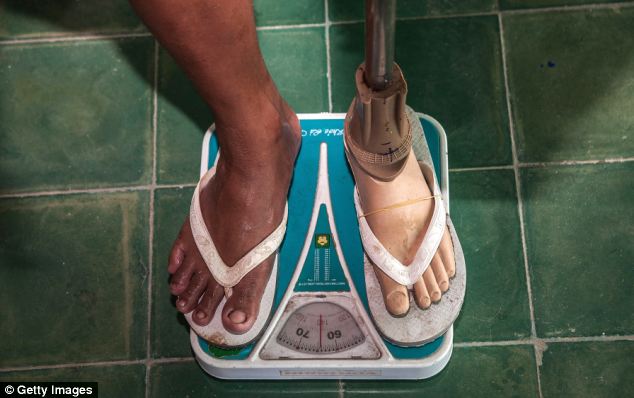 Weigh in: A patient takes to the scales in his recovery from a life-changing injury