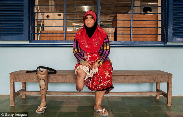 Injury: A woman poses with her prosthetic leg at a rehabilitation centre in Kampong Cham, Cambodia