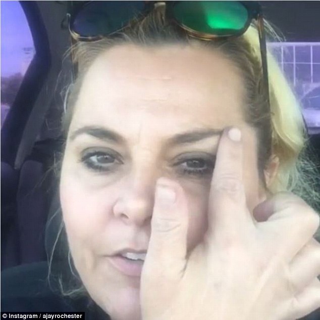 'It's just starting to come in now': The reality TV star pointed out the eyelift she had done through the injections