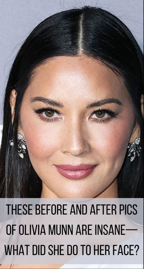 Before And After Makeup Transformation, Pink Celebrity, Celebrity Smokers, Bad Celebrity Plastic Surgery, Plastic Surgery Fails, Extreme Plastic Surgery, Celebrity Surgery, Face Plastic Surgery, Bad Plastic Surgeries