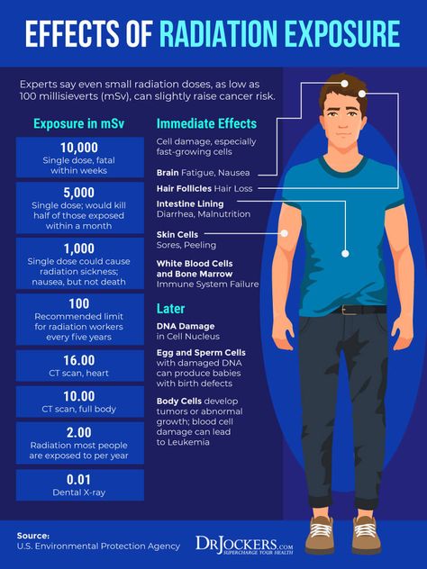 Radiation Exposure: Causes, Symptoms and Support Strategies Dr Jockers, Radiology Student, Diet Schedule, Radiation Exposure, Rock Hunting, Electromagnetic Radiation, Lose Pounds, Nursing Study, The Immune System