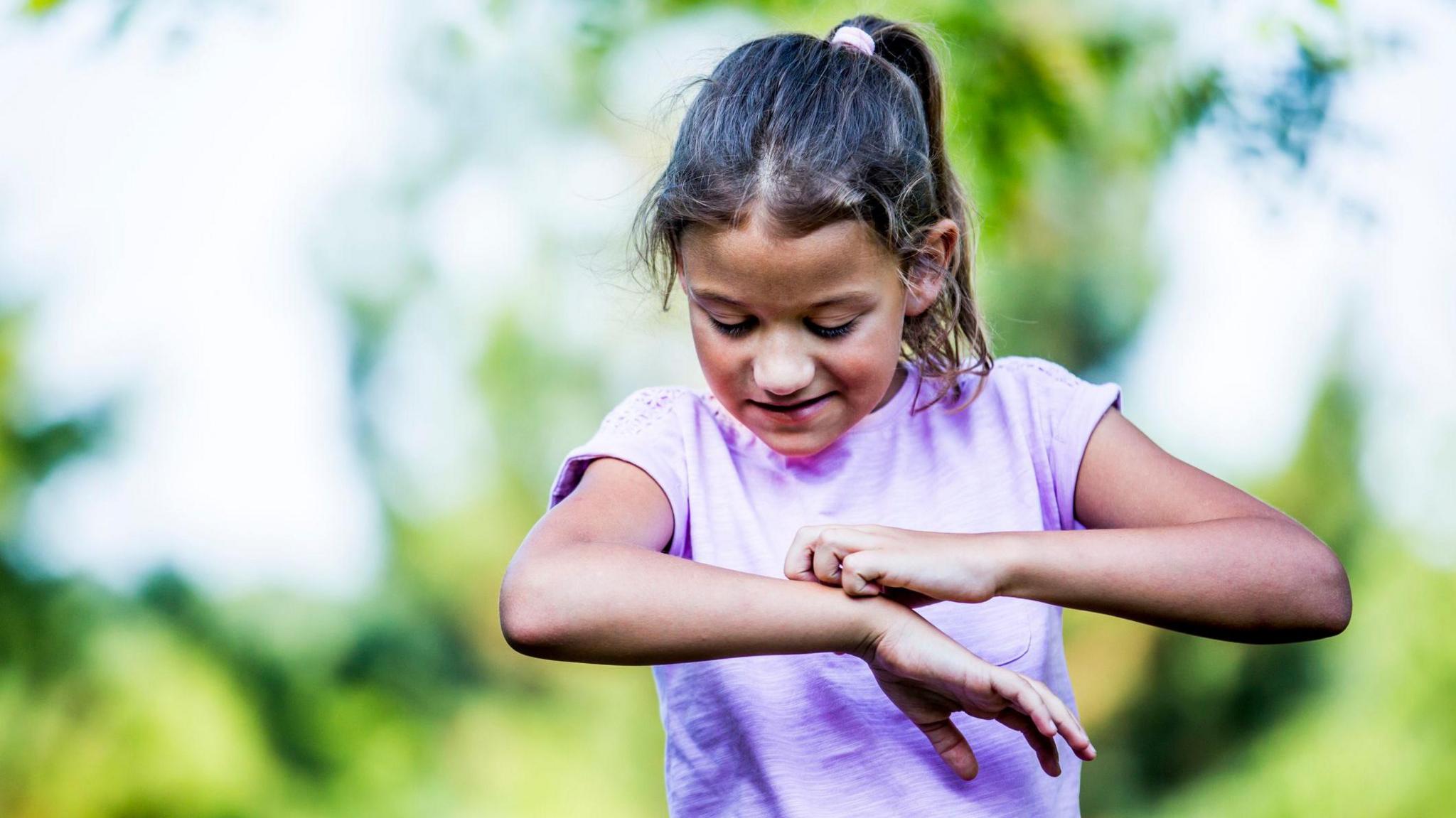 Girl scratching arm