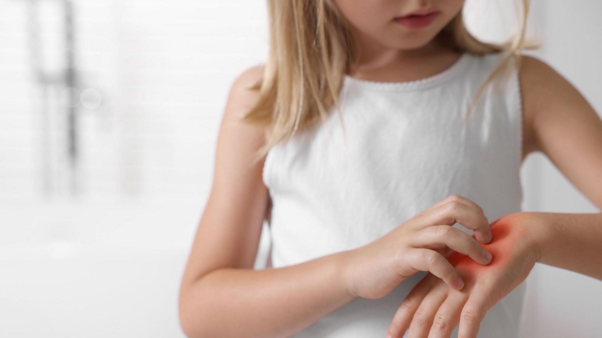 Girl scratching hand