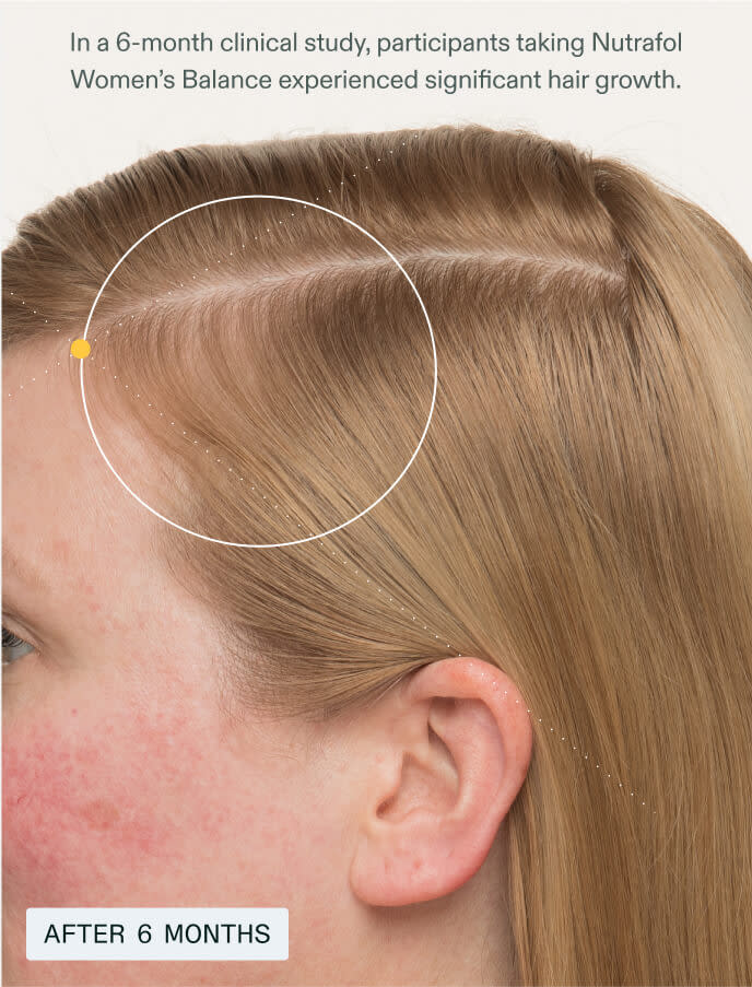 After 6 months - 
In a 6-month clinical study, participants taking Nutrafol Women’s Balance Hair Growth Nutraceutical experienced significant hair growth compared to those in the placebo group.
