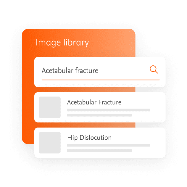 Image Library Acetabular Fracture Feature