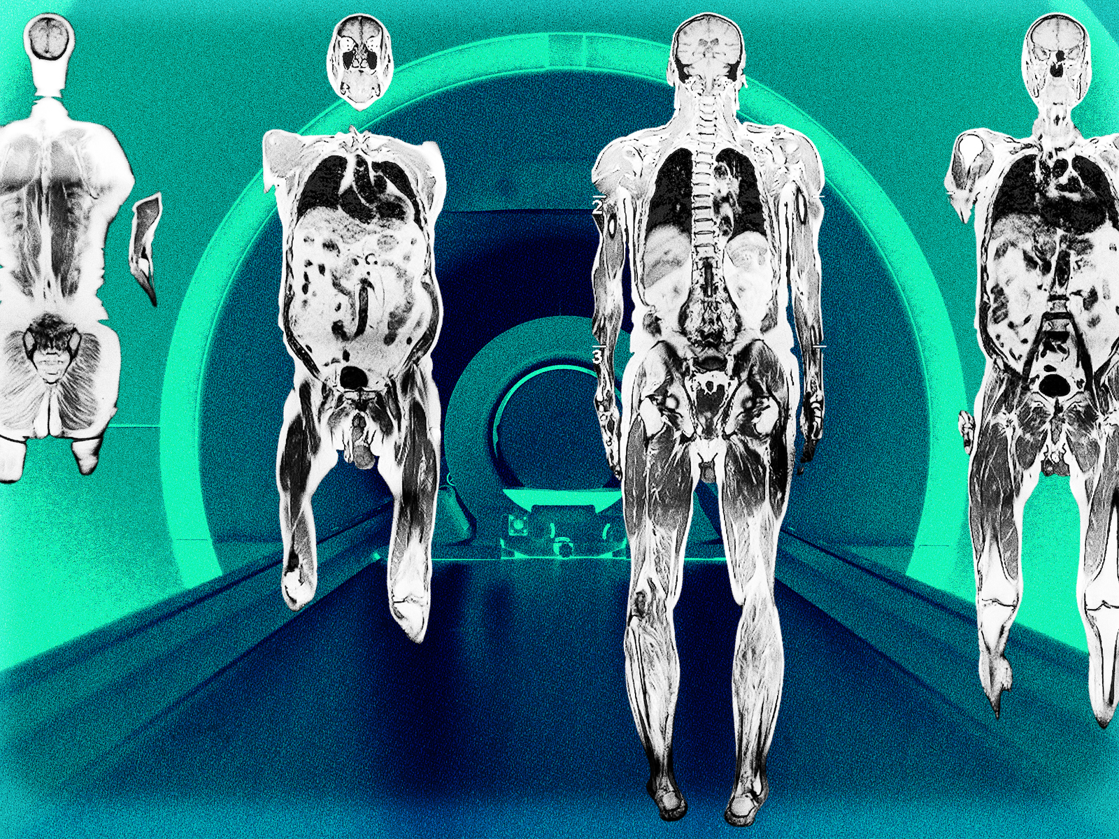 A Full-Body MRI is the Latest Wellness Status Symbol. Should You Get One in 2025?