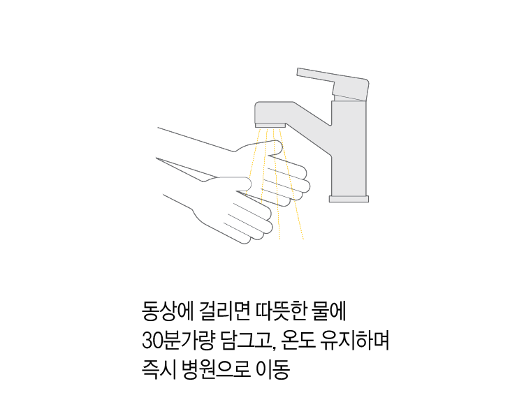 동상에 걸리면 따뜻한 물에 30분가량 담그고, 온도 유지하며 즉시 병원으로이동