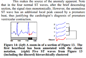 ECG0606 clusters