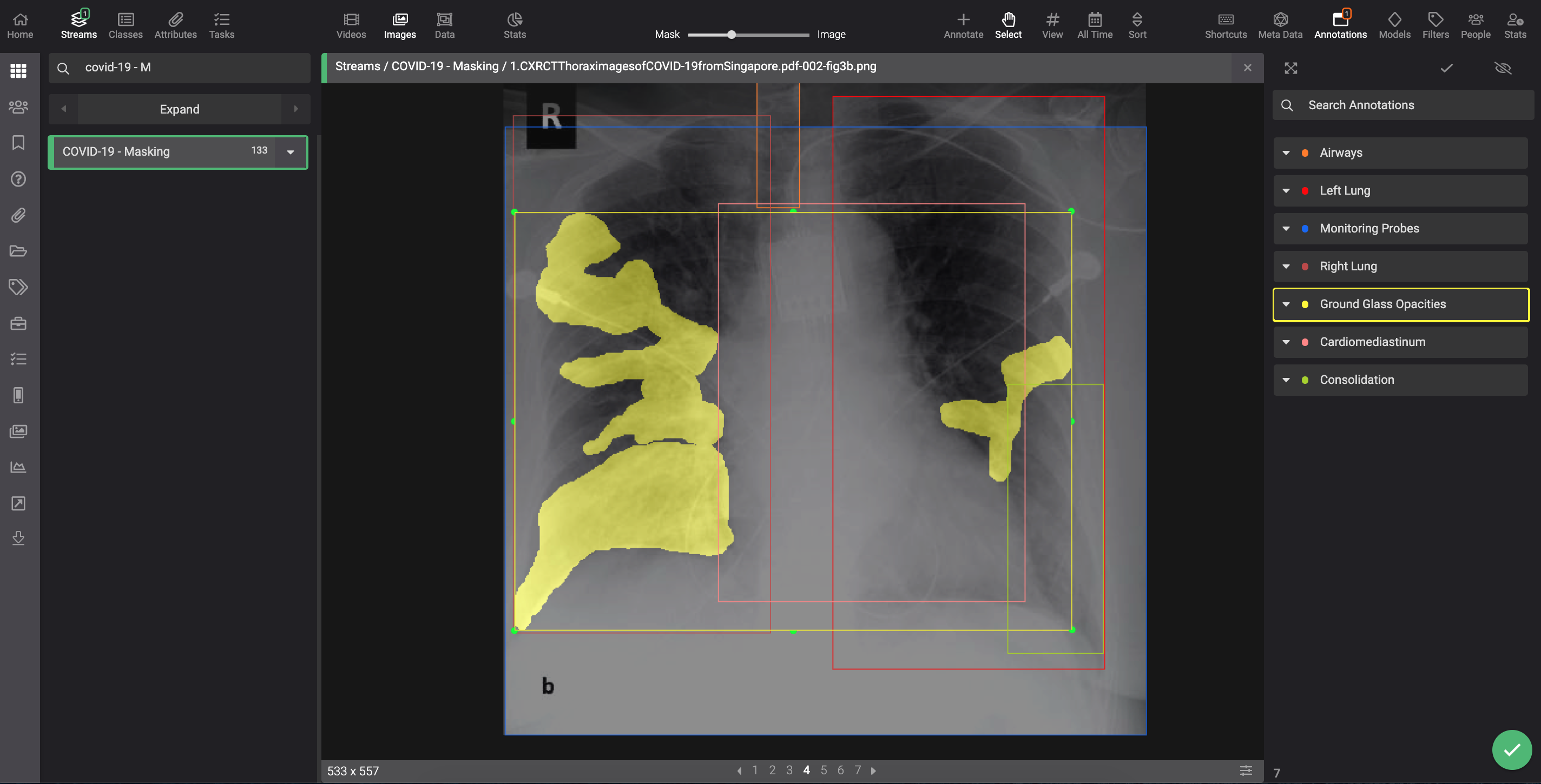 covid-19-chest-xray-segmentations-dataset