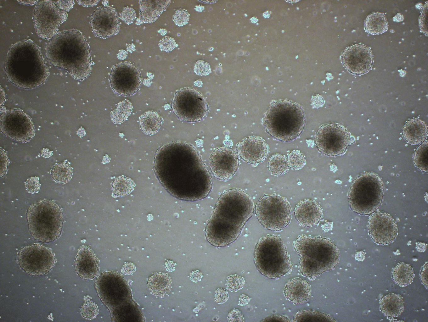 A scattering of brown-colored cells in a variety of sizes.