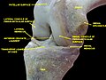 Knee joint, deep dissection, anteromedial view