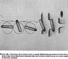 A illustration shows the bullet, which had hit Kennedy a moment before, rotating and tumbling before entering Connally's skin, causing his entry wound.