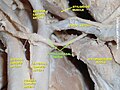 Hypoglossal nerve