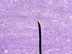 Microscopic cross section of the renal cortex