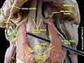 Hypoglossal nerve