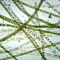 Image 3Zygnema. 10× objective, 15× eyepiece; numbered ticks are 122 µM apart.